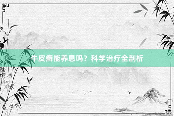 牛皮癣能养息吗？科学治疗全剖析